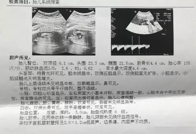 殲-11B重型戰(zhàn)斗機，卓越性能與先進技術(shù)的完美結(jié)合，殲-11B重型戰(zhàn)斗機，卓越性能與技術(shù)的巔峰融合