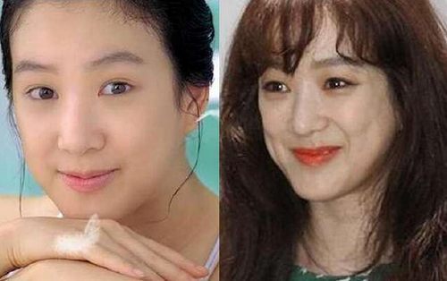 揭秘，韓國(guó)整容失敗的十大明星，揭秘，韓國(guó)整容失敗的明星TOP 10名單曝光