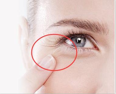 如何去除魚尾紋，最佳方法與實(shí)用建議，去除魚尾紋，最佳方法與實(shí)用建議攻略