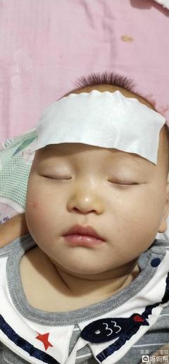 小孩子發(fā)燒39度怎么退燒最快？全面指南與關(guān)鍵措施，全面指南，兒童高燒39度快速退燒方法與關(guān)鍵措施