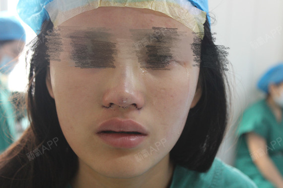 不動手術(shù)縮小鼻頭，自然方法與實(shí)用技巧，自然縮小鼻頭的方法與實(shí)用技巧分享