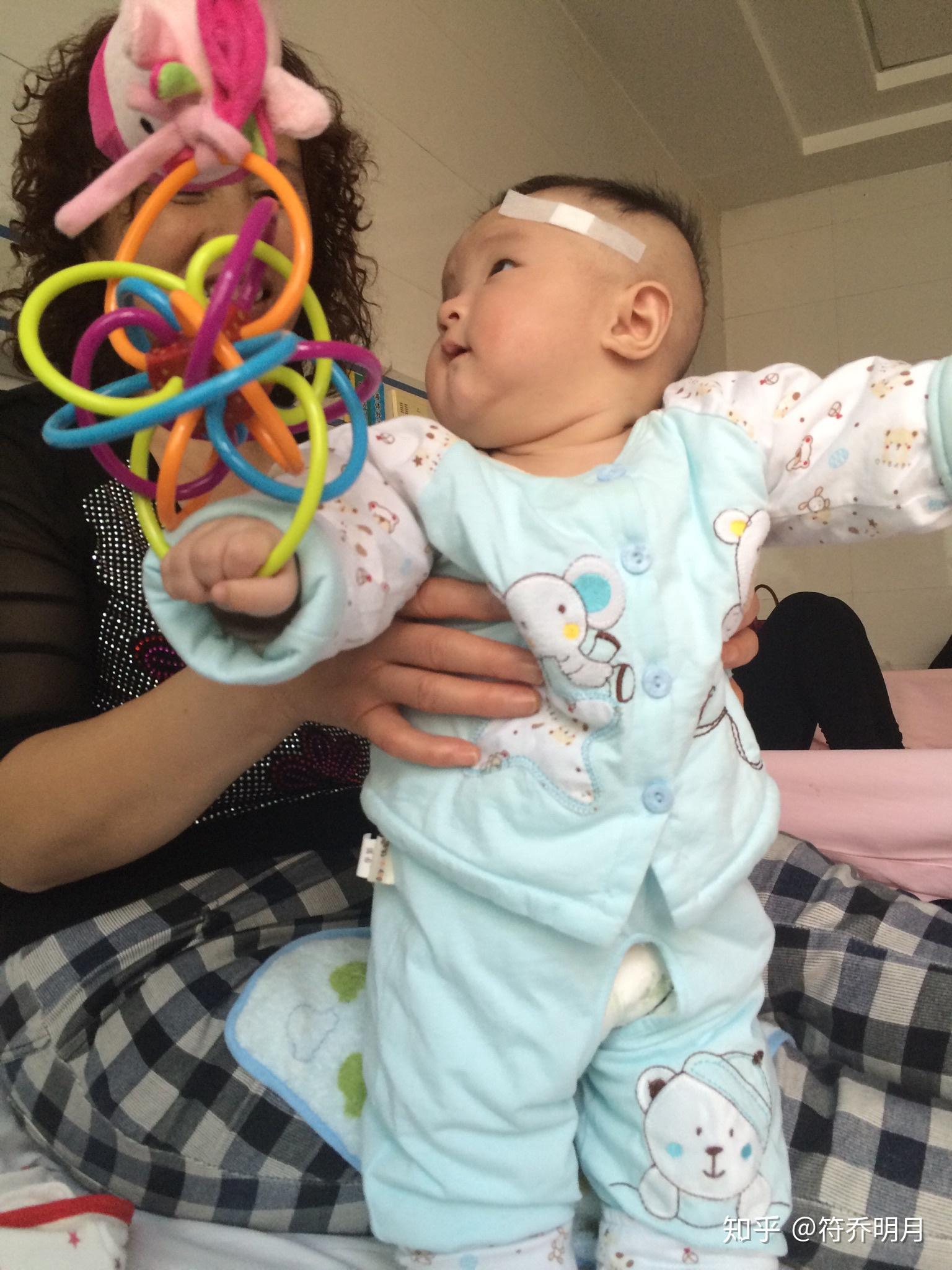 二個月嬰兒腦癱最明顯的特征，二個月嬰兒腦癱最明顯的特征表現(xiàn)