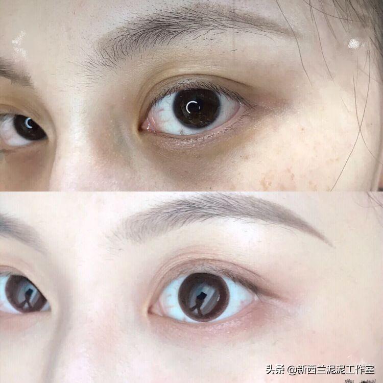 眼紋嚴重？快速有效的去眼紋方法大揭秘，揭秘快速有效的去眼紋方法，告別眼部皺紋煩惱！