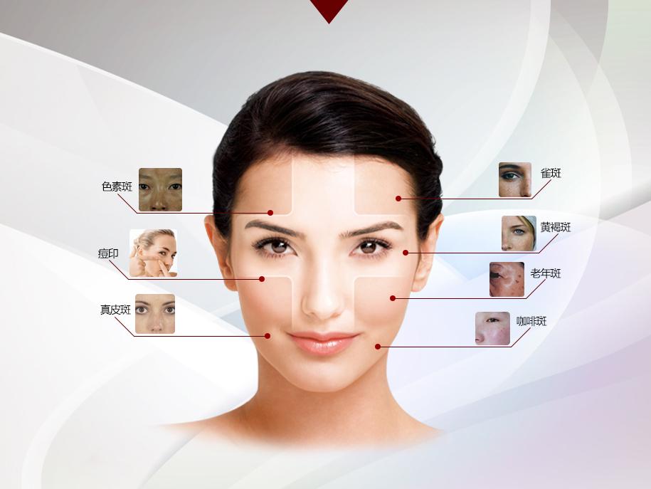 激光祛斑，一次能否徹底去除斑點？，激光祛斑能否一次徹底去除斑點？