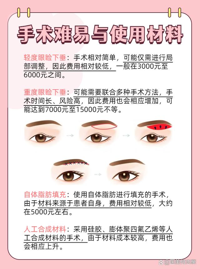 眼瞼下垂手術(shù)費(fèi)用詳解，大約多少錢？，眼瞼下垂手術(shù)費(fèi)用解析，手術(shù)費(fèi)用究竟是多少？