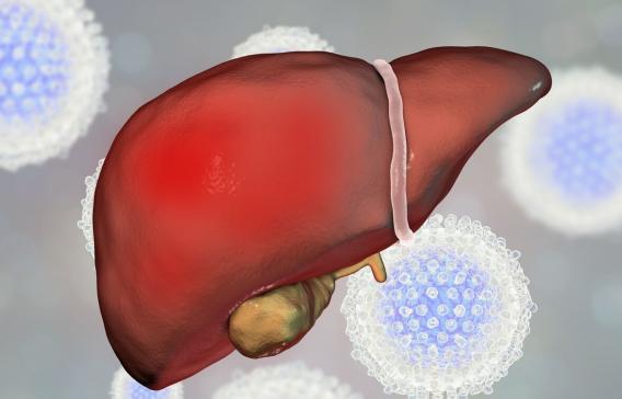 肝硬化的癥狀及表現，肝硬化的癥狀與表現概述
