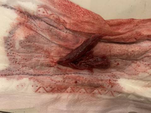 月經(jīng)排出爛肉是好事嗎？解讀月經(jīng)中的異物及其背后的健康信號，月經(jīng)排出爛肉現(xiàn)象解析，月經(jīng)中的異物與健康信號探討