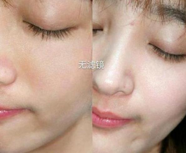 探索美白秘訣，五種讓臉部肌膚快速變白的方法，五種方法助你快速美白臉部肌膚，探索美白秘訣！