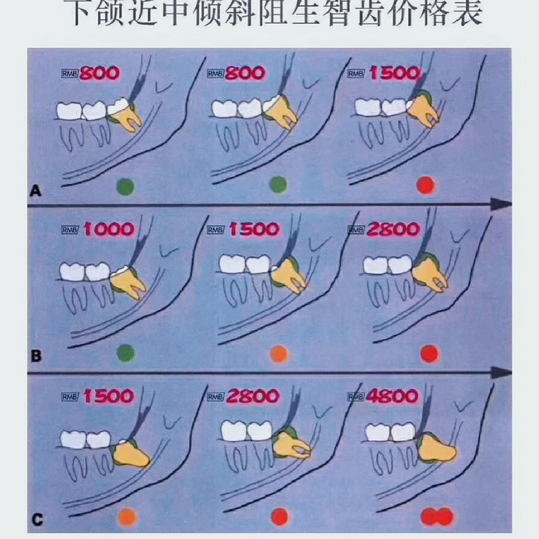 拔智齒收費(fèi)標(biāo)準(zhǔn)的全面解析，拔智齒收費(fèi)標(biāo)準(zhǔn)的深度解析與探討