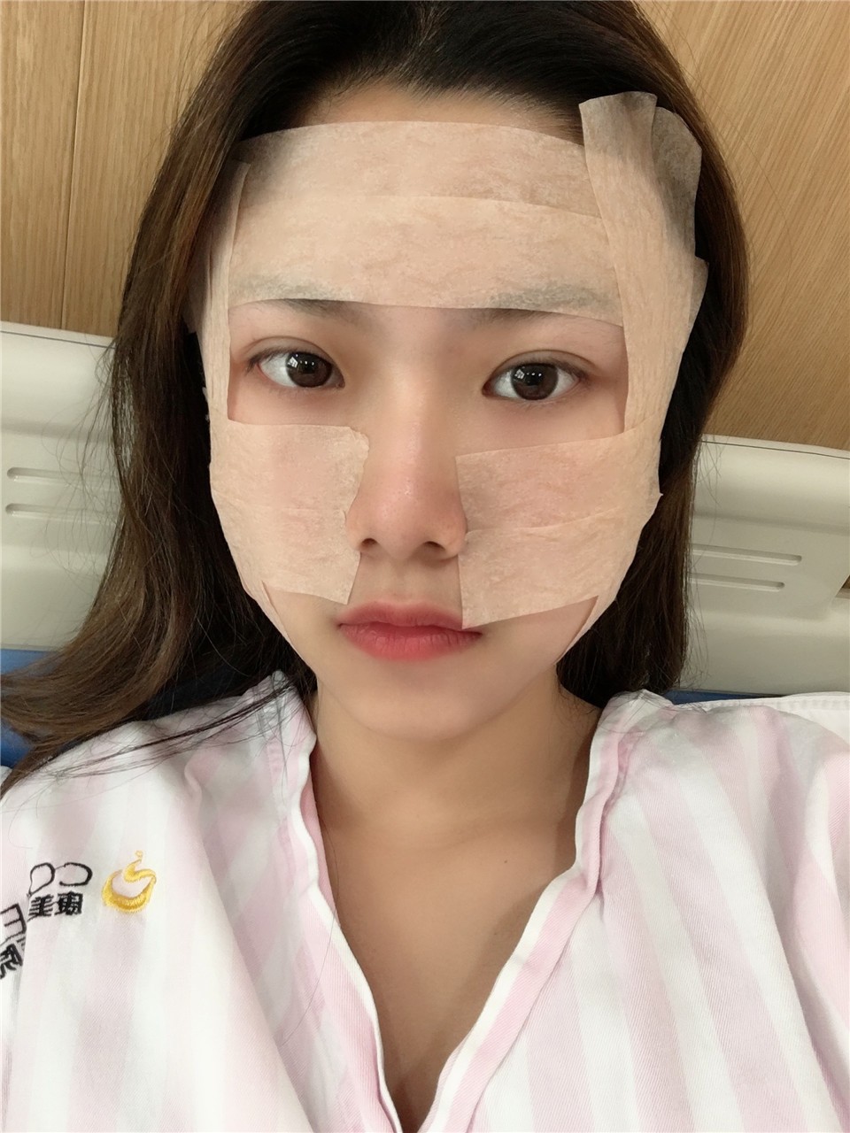 面部吸脂手術(shù)，重塑美麗輪廓的先進選擇，面部吸脂手術(shù)，重塑輪廓的先進之選