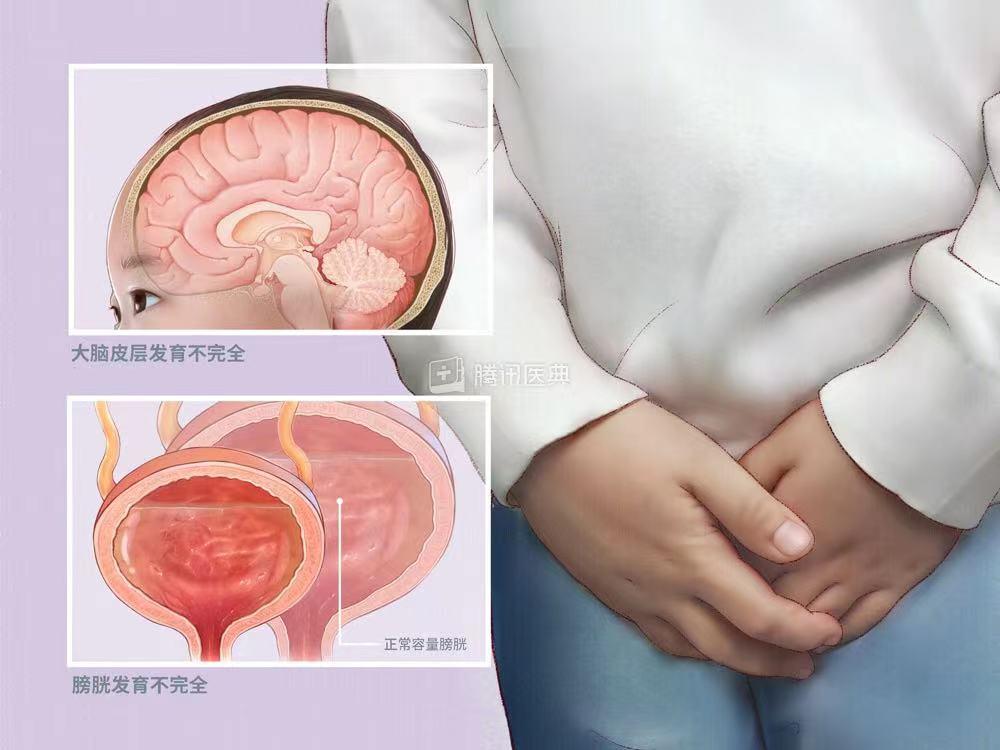 龜頭炎的癥狀表現(xiàn)及其影響，龜頭炎的癥狀表現(xiàn)及其影響分析