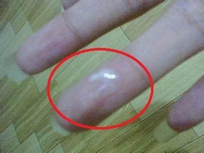 關(guān)于白帶異常，用手摳出豆腐渣狀白帶的解讀與處理建議，白帶異常解讀，豆腐渣狀白帶及處理建議