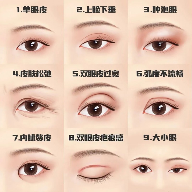 雙眼皮下垂怎么解決——專(zhuān)業(yè)方法與日常護(hù)理建議，雙眼皮下垂解決方法，專(zhuān)業(yè)方法與日常護(hù)理指南