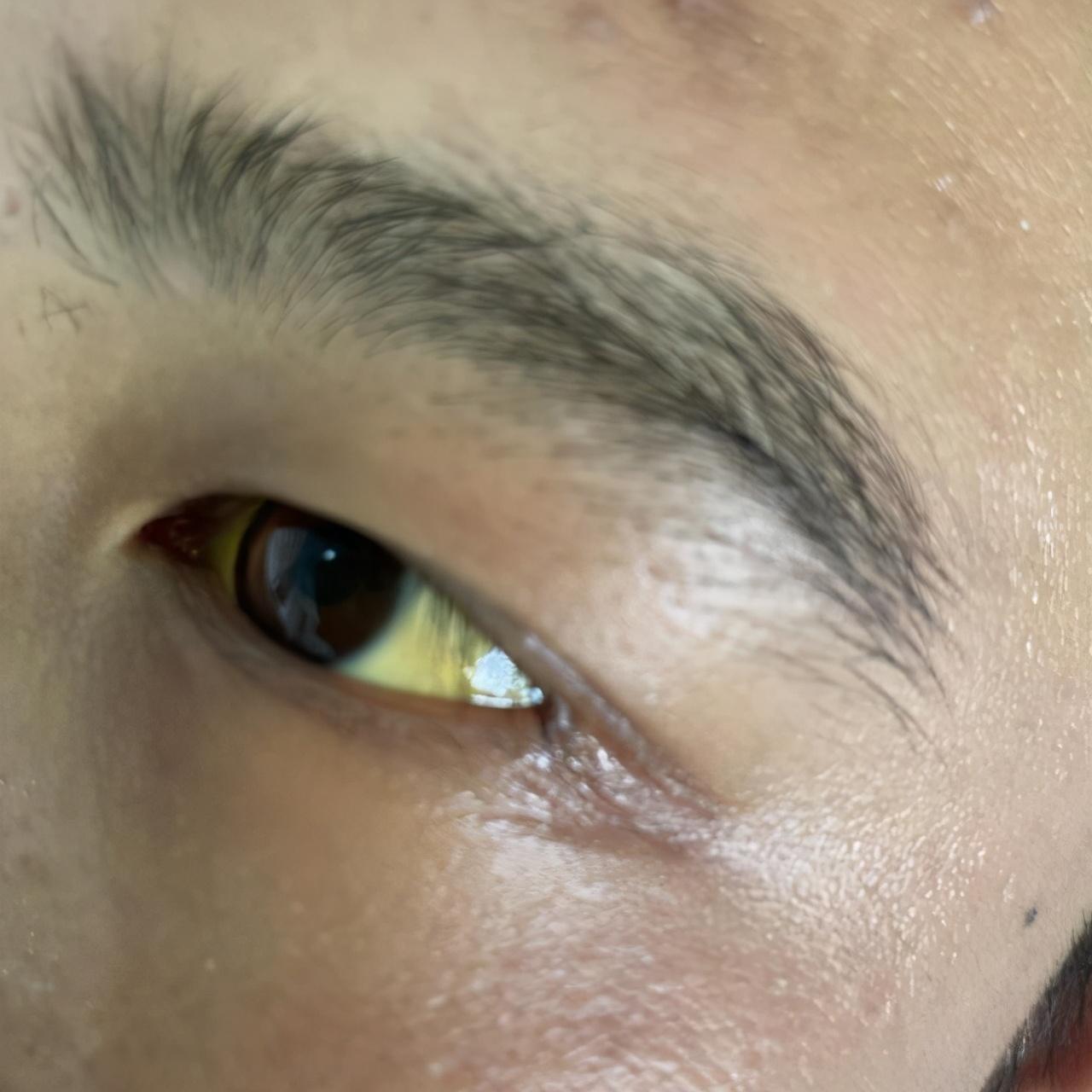 肝功能正常值參考表及其重要性，肝功能正常值參考表，揭示肝臟健康的關(guān)鍵指標(biāo)及其重要性