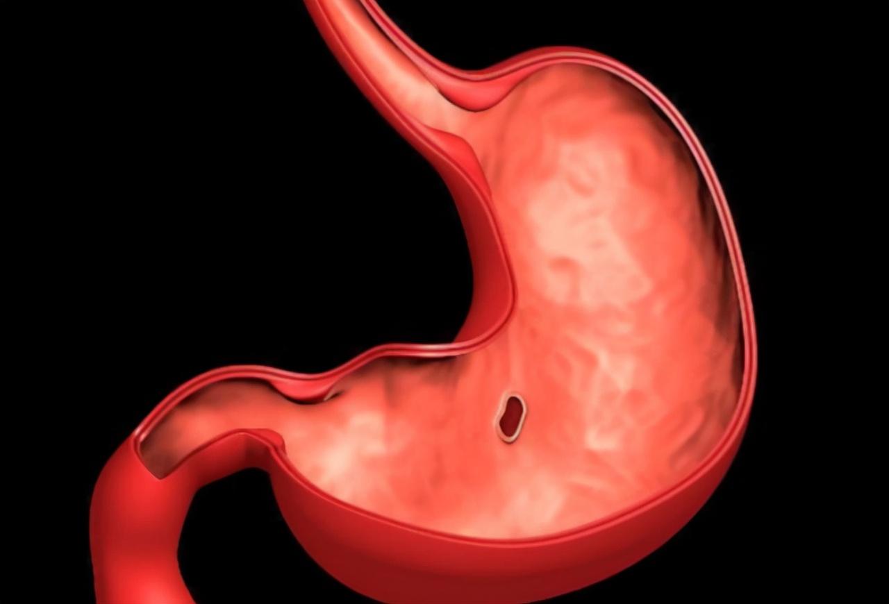 做胃鏡對胃傷害有多大，深入了解與關(guān)注，胃鏡對胃的影響，深入了解與關(guān)注