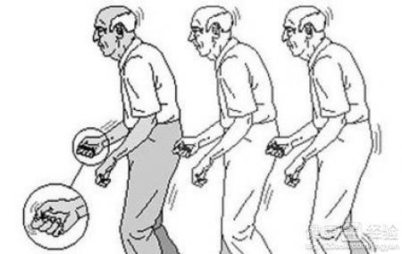 帕金森病的癥狀，深入了解與應(yīng)對，帕金森病癥狀詳解及應(yīng)對策略