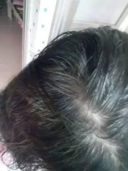 白發(fā)變黑發(fā)最快土法——自然黑發(fā)秘訣大揭秘，自然黑發(fā)秘訣，白發(fā)轉(zhuǎn)黑發(fā)最快土法大揭秘