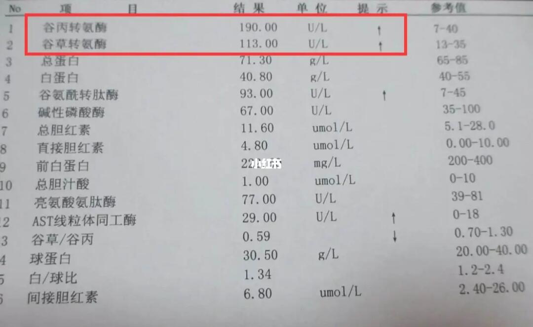 轉(zhuǎn)氨酶高多少是肝炎？解讀肝炎與轉(zhuǎn)氨酶水平的關(guān)系，解讀肝炎與轉(zhuǎn)氨酶水平關(guān)系，轉(zhuǎn)氨酶高多少可判定為肝炎？