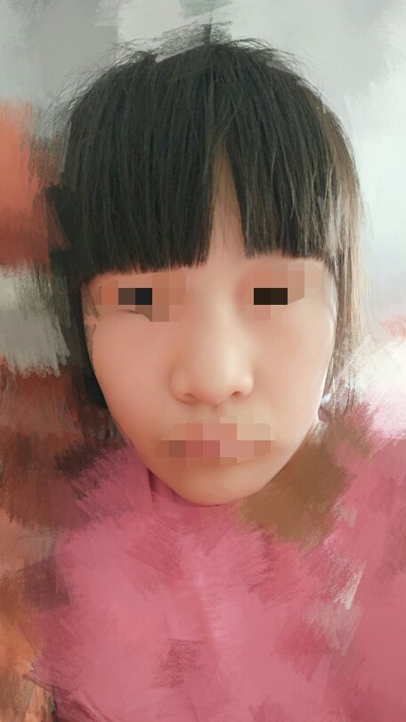 鼻子幾歲開始挺高，生長發(fā)育中的奧秘，揭秘鼻子發(fā)育奧秘，幾歲開始挺高？生長發(fā)育中的變化與規(guī)律