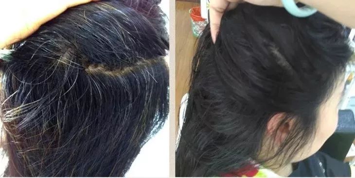 白發(fā)轉(zhuǎn)黑發(fā)，可能性與實現(xiàn)方法，白發(fā)轉(zhuǎn)黑發(fā)的可能性與實現(xiàn)方法探討