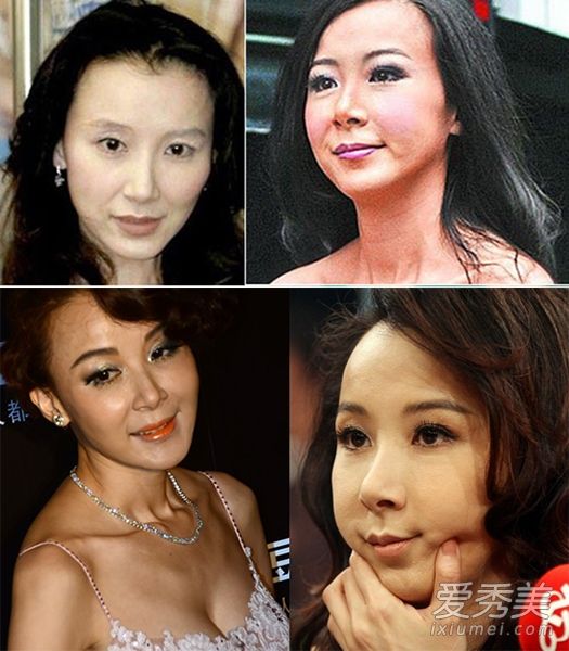 中國整容最自然的女明星，自然美與藝術(shù)的完美結(jié)合，中國整容最自然的女明星，自然美與藝術(shù)的和諧融合