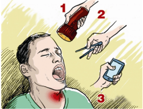 魚刺卡喉嚨自救有妙招，魚刺卡喉自救技巧大揭秘