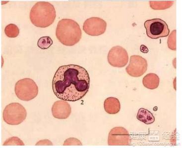 地中海貧血能生小孩嗎，全面理解與生育決策，地中海貧血患者的生育決策，全面理解與探討