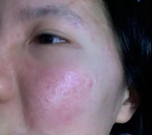 保養(yǎng)皮膚的最好方法，保養(yǎng)皮膚的最佳方法