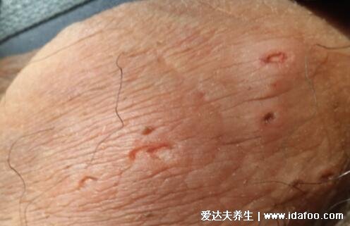 得性疾病前兆，了解、預(yù)防與應(yīng)對(duì)，得性疾病的早期信號(hào)，了解、預(yù)防與應(yīng)對(duì)策略