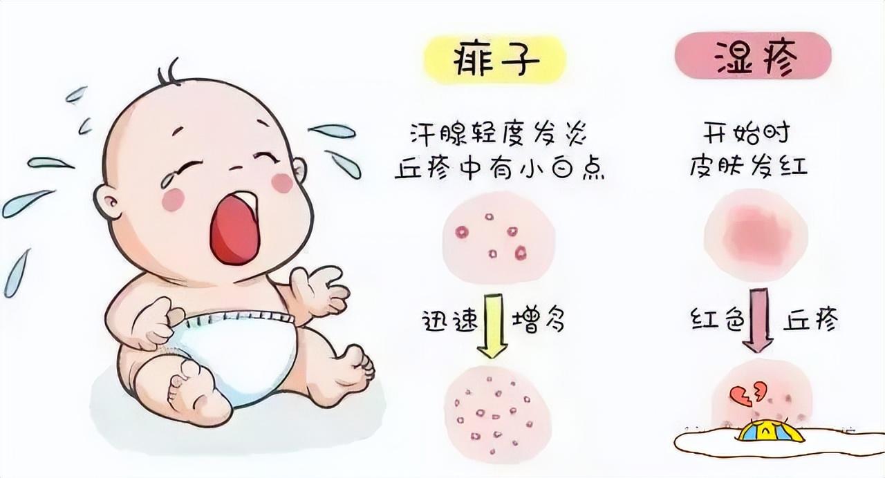 痱子和濕疹的區(qū)別，深入了解兩種常見皮膚狀況，痱子和濕疹的區(qū)別，常見皮膚狀況詳解