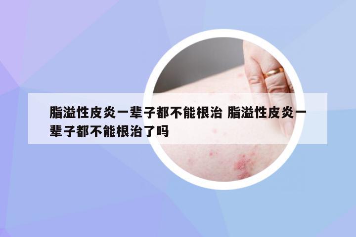 脂溢性皮炎，并非終身無法根治的疾病，脂溢性皮炎并非無法根治，治療策略助你擺脫困擾